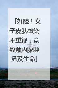好险！女子皮肤感染不重视，竟致颅内脓肿危及生命
